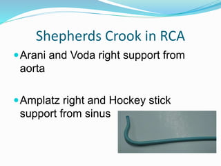 Shepherds Crook in RCA
Arani and Voda right support from
aorta
Amplatz right and Hockey stick
support from sinus
 