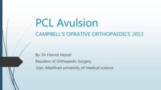 PCL Avulsion
CAMPBELL’S OPRATIVE ORTHOPAEDICS 2013
By: Dr Hamid Hejrati
Resident of Orthopedic Surgery
Iran, Mashhad university of medical science
 
