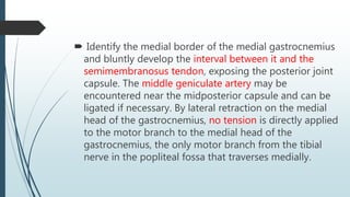  Identify the medial border of the medial gastrocnemius
and bluntly develop the interval between it and the
semimembranosus tendon, exposing the posterior joint
capsule. The middle geniculate artery may be
encountered near the midposterior capsule and can be
ligated if necessary. By lateral retraction on the medial
head of the gastrocnemius, no tension is directly applied
to the motor branch to the medial head of the
gastrocnemius, the only motor branch from the tibial
nerve in the popliteal fossa that traverses medially.
 