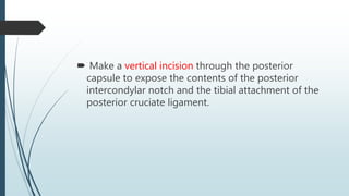  Make a vertical incision through the posterior
capsule to expose the contents of the posterior
intercondylar notch and the tibial attachment of the
posterior cruciate ligament.
 
