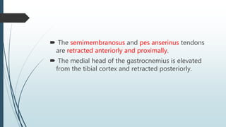  The semimembranosus and pes anserinus tendons
are retracted anteriorly and proximally.
 The medial head of the gastrocnemius is elevated
from the tibial cortex and retracted posteriorly.
 