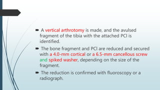  A vertical arthrotomy is made, and the avulsed
fragment of the tibia with the attached PCl is
identified.
 The bone fragment and PCl are reduced and secured
with a 4.0-mm cortical or a 6.5-mm cancellous screw
and spiked washer, depending on the size of the
fragment.
 The reduction is confirmed with fluoroscopy or a
radiograph.
 