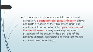  In the absence of a major medial compartment
disruption, a posteromedial capsular incision allows
adequate exposure of the tibial attachment. The
most medial portion of an intact posterior horn of
the medial meniscus may make exposure and
placement of the suture in the distal end of the
ligament difficult, but excision of the intact medial
meniscus is not necessary.
 