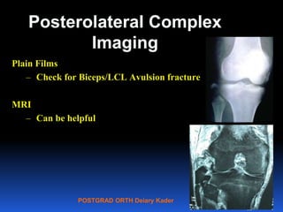 POSTGRAD ORTH Deiary Kader
Posterolateral Complex
Imaging
Plain Films
– Check for Biceps/LCL Avulsion fracture
MRI
– Can be helpful
32
 