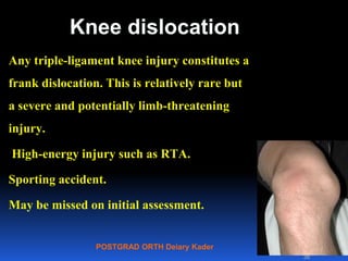 POSTGRAD ORTH Deiary Kader
Knee dislocation
Any triple-ligament knee injury constitutes a
frank dislocation. This is relatively rare but
a severe and potentially limb-threatening
injury.
High-energy injury such as RTA.
Sporting accident.
May be missed on initial assessment.
38
 