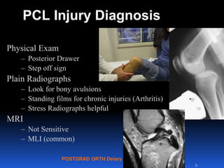POSTGRAD ORTH Deiary Kader
PCL Injury Diagnosis
9
Physical Exam
– Posterior Drawer
– Step off sign
Plain Radiographs
– Look for bony avulsions
– Standing films for chronic injuries (Arthritis)
– Stress Radiographs helpful
MRI
– Not Sensitive
– MLI (common)
 