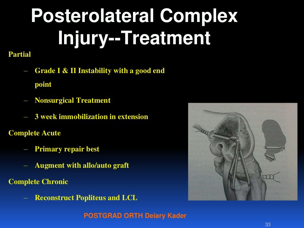 Updated pcl, plc and knee dislocation for postgraduate – posterior ...