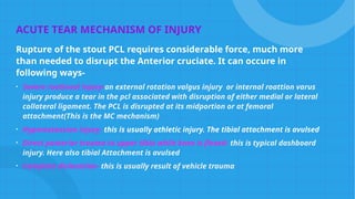Pc Line Injury PCL TEAR.pptx posterior cruciate ligament injury | PPTX