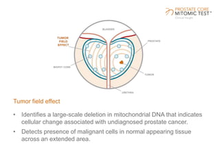 Tumor field effect
• Identifies a large-scale deletion in mitochondrial DNA that indicates
cellular change associated with undiagnosed prostate cancer.
• Detects presence of malignant cells in normal appearing tissue
across an extended area.
 