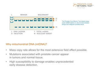 Why mitochondrial DNA (mtDNA)?
• Mass copy rate allows for the most extensive field effect possible.
• Mutations associated with prostate cancer appear
in tumors and normal tissue.
• High susceptibility to damage enables unprecedented
early disease detection.
The Prostate Core Mitomic Test detects large-
scale mtDNA deletion to discriminate between
benign and malignant prostate tissue.
 
