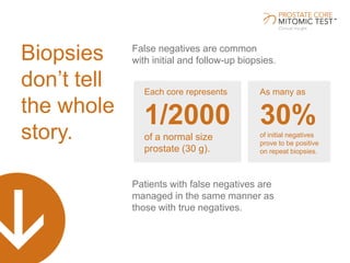 False negatives are common
with initial and follow-up biopsies.
Patients with false negatives are
managed in the same manner as
those with true negatives.
Biopsies
don’t tell
the whole
story.
Each core represents
1/2000
of a normal size
prostate (30 g).
As many as
30%of initial negatives
prove to be positive
on repeat biopsies.
 