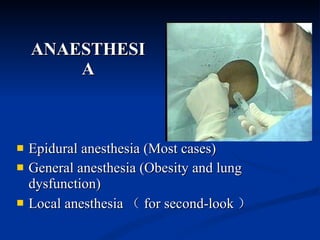 ANAESTHESIA Epidural anesthesia (Most cases) G eneral anesthesia  (Obesity and lung dysfunction) Local anesthesia （ for second-look ） 
