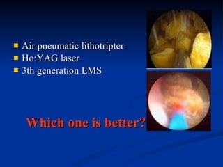 Air pneumatic lithotripter Ho:YAG laser  3th generation EMS Which one is better? 