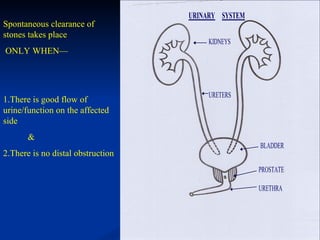 Spontaneous clearance of stones takes place  ONLY WHEN— 1.There is good flow of urine/function on the affected side & 2.There is no distal obstruction 