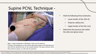 PCNL puncture Technique. Describe variation of puncture | PPTX