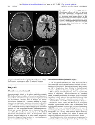 From bloodjournal.hematologylibrary.org by guest on July 25, 2011. For personal use only.
512

FERRERI

BLOOD, 21 JULY 2011 ⅐ VOLUME 118, NUMBER 3

Figure 2. Neuroimaging example of PCNSL. MRI of the
brain showing an expansive mass lesion in the right frontal
lobe, which is hypointense in noncontrasted T1 scans
(A), isointense with respect to cortex in T2-weighted images
(C), with reduced average diffusion coefﬁcient (B), and
homogeneous contrast enhancement in contrasted T1 weighted
scans (D arrows). Lesion is surrounded by modest edema
(A arrows). CT and MRI ﬁndings are attributed to the high cell
density and scant cytoplasm. Enhancement along the
Virchow-Robin spaces, although not constant, is a highly
speciﬁc feature of PCNSL.

progressive multifocal leukoencephalopathy are the main differential diagnoses, requiring brain biopsy for deﬁnitive diagnosis.

Diagnosis
When is tumor resection indicated?

Stereotactic-guided biopsy is the chosen method to diagnose
PCNSL. Its morbidity is very low and permits the rapid detection of
tumor cells in intraoperative analysis; however, samples are small
and it could have a negative effect on diagnosis and biologic
investigations. Patients with a radiologic suspicion of gliomas,
metastasis, meningiomas, or other tumors are routinely referred for
complete resection, sometimes resulting in an unexpected diagnosis of lymphoma. Conversely, I advise strongly against gross tumor
resection if PCNSL is suspected because it can induce neurologic
deﬁcits and treatment delays and has not been associated with
survival beneﬁts according to a meta-analysis of 50 published
prospective and retrospective series.7 In these patients, tumor
resection should be reserved for the timely control of neurologic
deterioration because of brain herniation or ventricle dilation to
provide prompt treatment in “ﬁt” patients.

Should steroids be interrupted before biopsy?

As with most patients who have been newly diagnosed with an
intracranial mass, steroids are also routinely prescribed to PCNSL
patients to rapidly improve neurologic performance and to reduce
the risk of complications. Mass shrinking is obtained through
antiedema and cytotoxic effects, causing radiographic regression in
ϳ 40% of patients (“vanishing tumor”), which is suggestive for
PCNSL. As many others, I believe that detection of a “vanishing
tumor” should not be considered as diagnostic of PCNSL because
sarcoidosis, multiple sclerosis, acute encephalomyelitis, and other
malignancies can also exhibit a dramatic response to steroids.8
Steroid effects can interfere with histopathologic diagnosis.
Although some authors reported that PCNSL can be successfully
diagnosed without stopping steroids,9 there is consensus that these
drugs should be withheld in patients with a presumptive diagnosis
of PCNSL until tissue is obtained, limiting its use to cases of
osmotherapy inefﬁcacy.10 In our institution, we interrupt steroid
therapy for at least 7-10 days before biopsy to improve diagnostic
yield. However, this measure is not needed in patients who
experience MRI-conﬁrmed disease progression under steroids.
Steroid administration during antilymphoma therapy should be
modiﬁed according to clinical requirements. During chemotherapy,

 