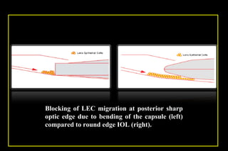 Pco - by dr. Heba mahmoud (M D)