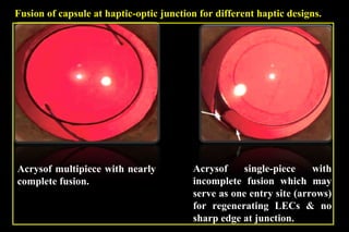 Pco - by dr. Heba mahmoud (M D)
