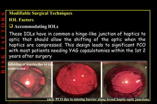 Pco - by dr. Heba mahmoud (M D)