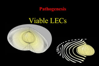 Pco - by dr. Heba mahmoud (M D)
