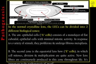 Pco - by dr. Heba mahmoud (M D)