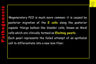 Pco - by dr. Heba mahmoud (M D)