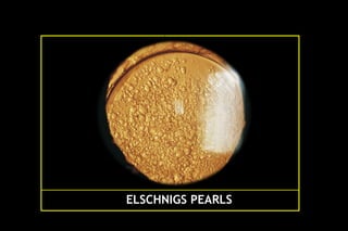 Pco - by dr. Heba mahmoud (M D)