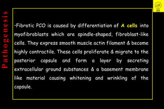 Pco - by dr. Heba mahmoud (M D)