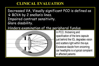 Pco - by dr. Heba mahmoud (M D)