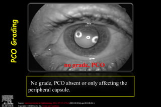 Pco - by dr. Heba mahmoud (M D)