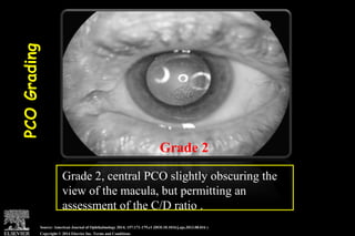 Pco - by dr. Heba mahmoud (M D)
