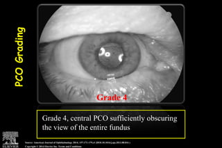 Pco - by dr. Heba mahmoud (M D)