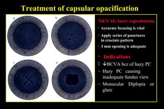 Pco - by dr. Heba mahmoud (M D)