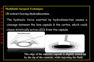 Pco - by dr. Heba mahmoud (M D)