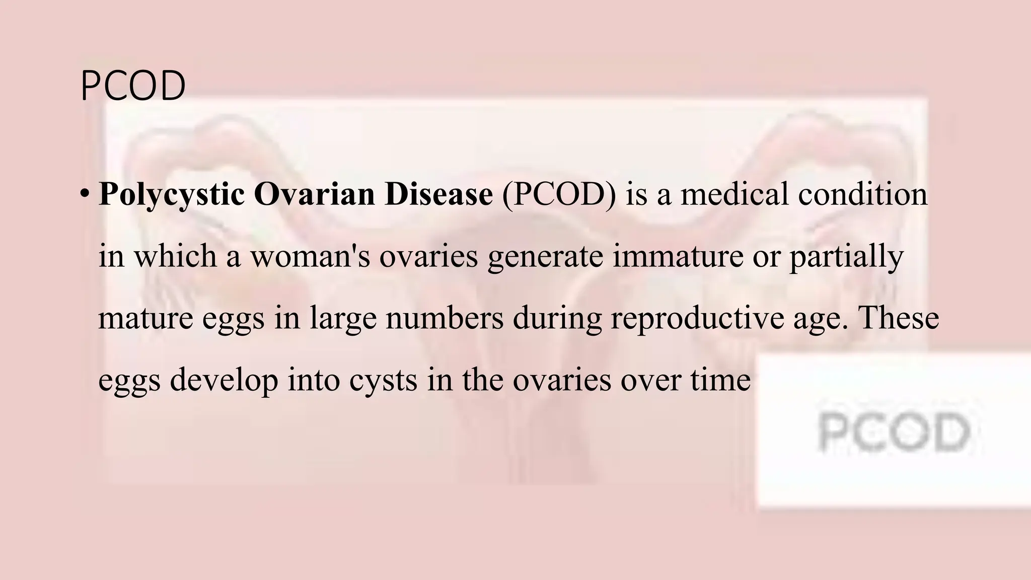 polycystic Ovarian Disease causes & Prevention | PPTX