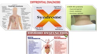 DIFFRENTIAL DIAGNOSIS
 