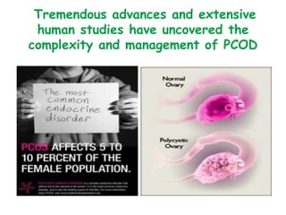 Pcod Modellen PCOD,How are they different ??Difficulties & Solutions made Easy , Dr ...