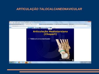 ARTICULAÇÃO TALOCALCANEONAVICULAR
 