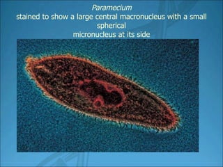 Paramecium stained to show a large central macronucleus with a small spherical micronucleus at its side