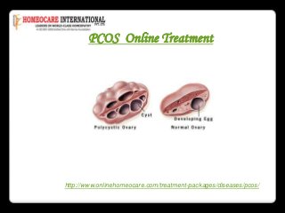 PCOS Online Treatment
http://www.onlinehomeocare.com/treatment-packages/diseases/pcos/
 