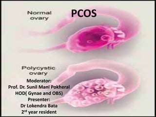 Moderator:
Prof. Dr. Sunil Mani Pokheral
HOD( Gynae and OBS)
Presenter:
Dr Lokendra Bata
2rd year resident
PCOS
 