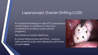 PCOS (polycystic ovarian syndrome) | PPTX