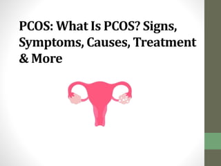 PCOS: What Is PCOS? Signs,
Symptoms, Causes, Treatment
& More
 