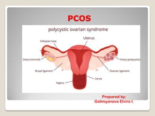 Pcos Journal PCOS.pdf