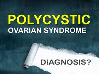 POLYCYSTIC
OVARIAN SYNDROME
 