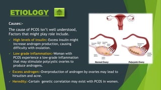ETIOLOGY
Causes:-
The cause of PCOS isn’t well understood,
Factors that might play role include.
 High levels of insulin:-Excess insulin might
increase androgen production, causing
difficulty with ovulation.
 Low grade inflammation:-Woman with
PCOS experience a low-grade inflammation
that may stimulate polycystic ovaries to
produce androgens.
 Excess androgen:-Overproduction of androgen by ovaries may lead to
hirsutism and acne.
 Heredity:-Certain genetic correlation may exist with PCOS in women.
 
