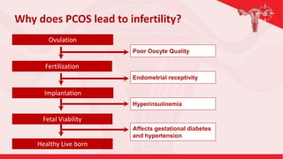 Ovulation
Fertilization
Implantation
Fetal Viability
Healthy Live born
Poor Oocyte Quality
Endometrial receptivity
Hyperinsulinemia
Affects gestational diabetes
and hypertension
Why does PCOS lead to infertility?
 