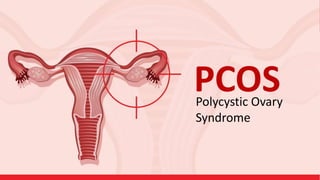 PCOS
Polycystic Ovary
Syndrome
 