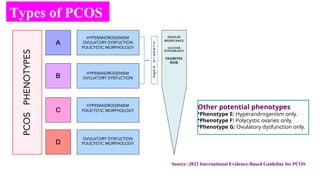 PCOS latest updates on diagnosis criteria and Novel Treatment | PPTX