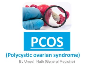 PCOS
(Polycystic ovarian syndrome)
By Umesh Nath (General Medicine)
 